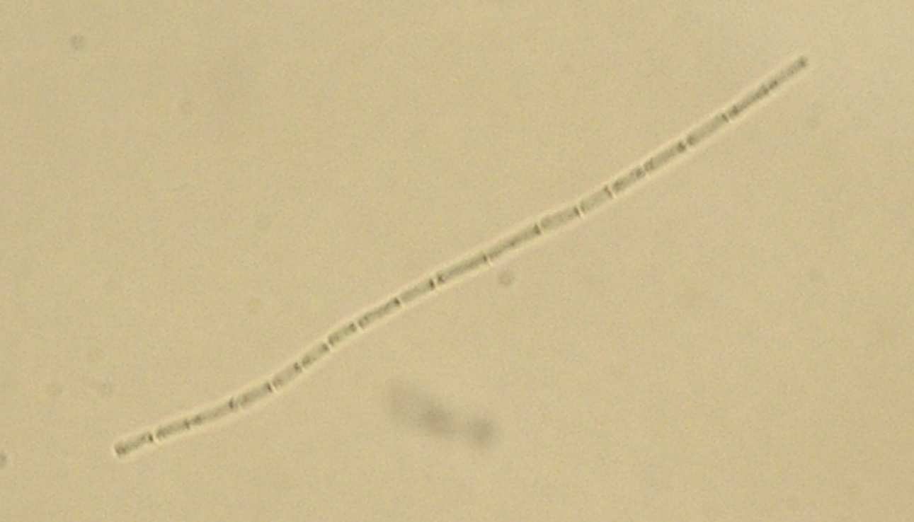 112 (a) (b) (c) Figura 18: Aspecto geral das cianobactérias encontradas na Lagoa do Peri e avaliadas no estudo (aumento 400 vezes). (a) C. raciborskii da Lagoa do Peri, aspecto geral; (b) C.