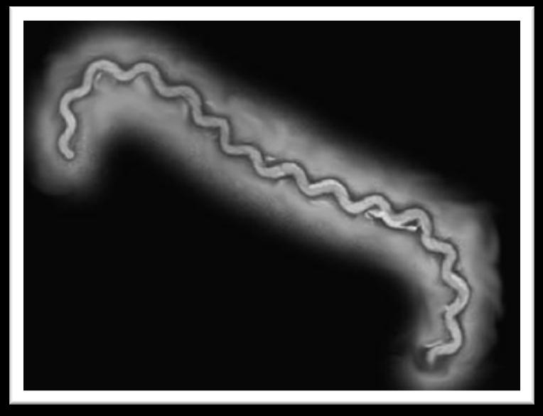 Leptospira Agente etiológico: Leptospira sp (bactéria) Zoonose eliminada principalmente na