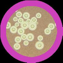 Penicillium Saccharomyces Tinea Stachybotrys Tamanho Máx. (nm)... 5000 Tamanho Máx. (nm)... 10 000 Tamanho Máx. (nm)... 15 000 Tamanho Máx. (nm)... 72 000 Número de estirpes... Perigo para o homem.