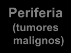 Periferia (tumores malignos) próstata Centro (tumores benignos) Isto significa que o tumor benigno apresenta dificuldades logo no