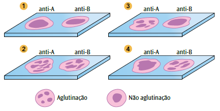 a) crianças dos grupos A e O podem nascer da união de indivíduos dos tipos determinados em 1 e 4. b) indivíduos do tipo determinado em 2 formam os dois tipos de antígenos.