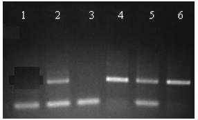 2014 - APOSTILA TURMA DE MEDICINA MÓDULO II Após o término de todos estes procedimentos, teremos em mãos o perfil de bandas do DNA que irá identificar a pessoa com extrema fidelidade e precisão.