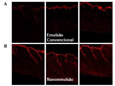 Nanoemulsões Penetração Folicular Figura 13: Fluorescência da pele tratada com emulsão