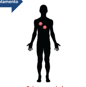 Tratamento como prevenção Testar e oferecer tratamento Alta carga viral