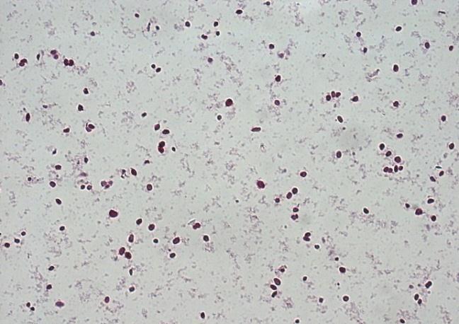 4 PCNA (proliferating cell nuclear antigen) PEPCase