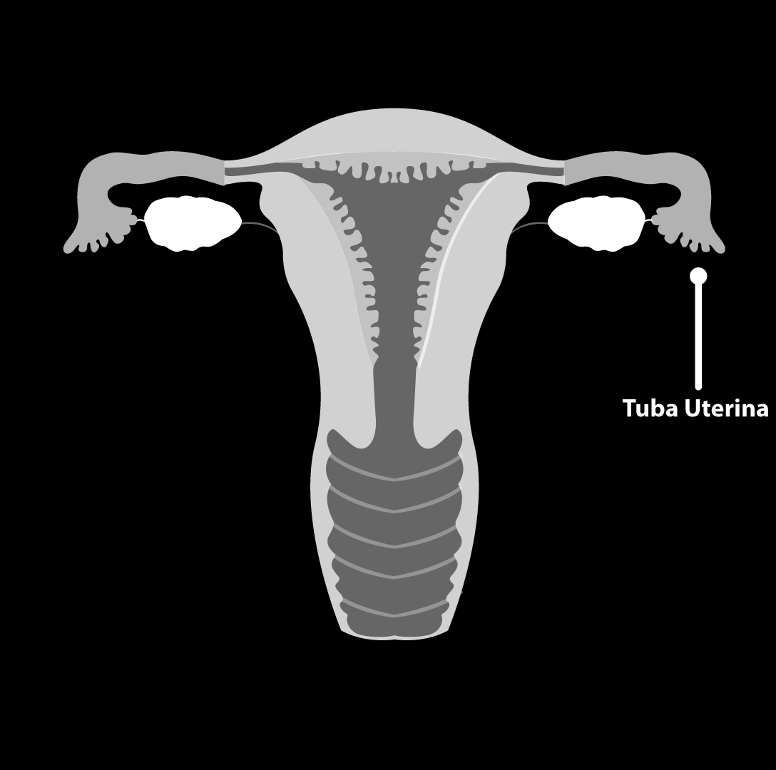 As tubas uterinas são aquelas que transportam os óvulos que