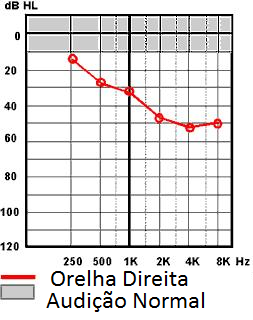 CAPÍTULO 2. A AUDIÇÃO 18 audiograma, e geralmente os valores indicados são de frequências iguais a 250Hz, 500Hz, 1kHz, 2kHz, 4kHz e 8kHz. As Figuras 2.2 e 2.