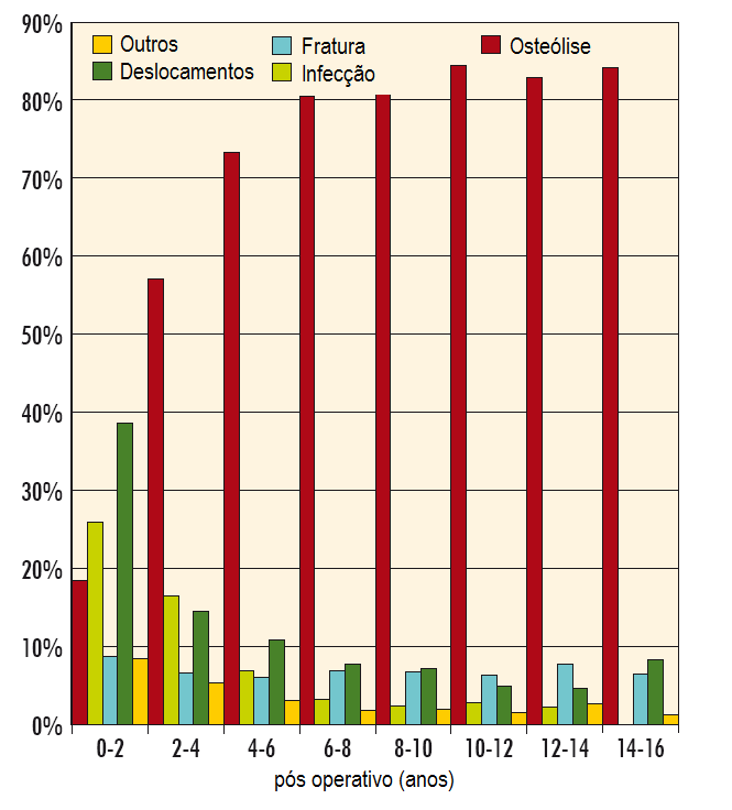 31 implante, dando continuidade ao processo de perda óssea e, conseqüentemente, o enfraquecimento da região de implantação da prótese (GOODMAN et al., 2005), como apresentado na Figura 5.