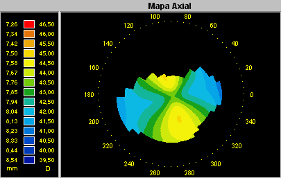 Capitulo 7 Lente de Contato 7. Lente de contato O módulo de lente de contato é uma excelente ferramenta a qual ajudará o médico no momento da prescrição de lentes de contato rígidas.