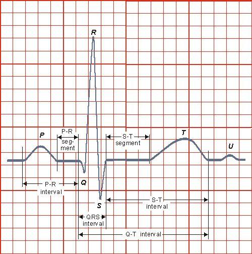 23 Fgura 3.5 Desenho esquemátco do eletrocardograma normal e seus componentes: onda P, complexo QRS e onda T.