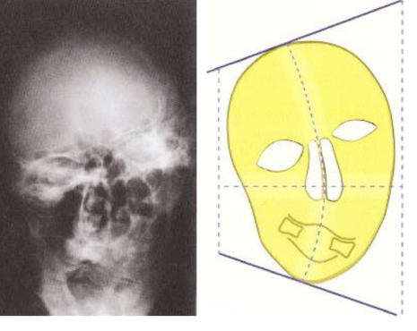 Cadernos Otorrinolaringologia. CLÍNICA, INVESTIGAÇÃO E INOVAÇÃO 7 Influência das cadeias cervicais sobre o osso hioide. Perlemuter, L; Waligora, J. Cahiers d Anatomie.