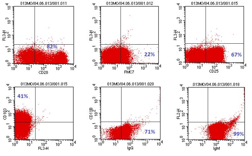 Elas expressam antígenos de linfócitos B como CD19, CD20 e CD22, mas não CD21; além desses estão presentes: CD11C, CD25 e CD103 (o CD103, é o marcador mais específico e sensível do HCL, está