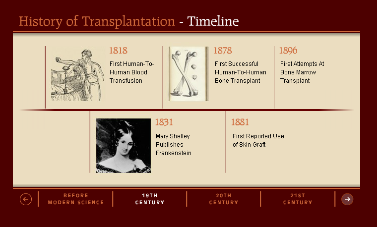 1905 1º transplante de córnea com sucesso 1908 1º transplante de joelho com sucesso 1944 1º banco de olhos nos EUA 1949 1º
