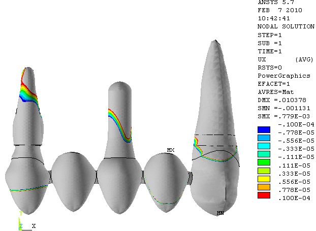 66 Figura 8- Deslocamento mésio distal (UX) Figura 9- Deslocamento no sentido mésio distal (UX).