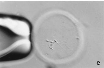 resultados Técnica : Cohen et al., Human Reprod.