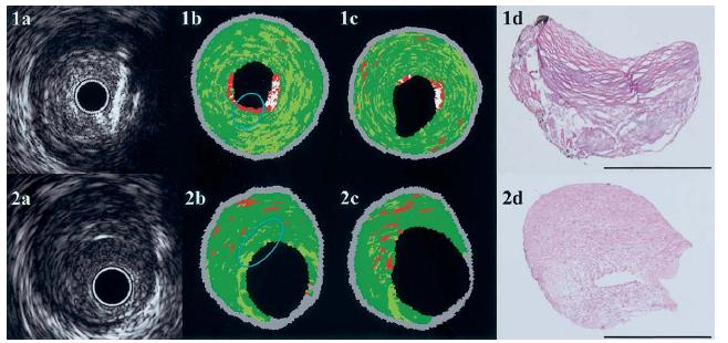 VH Overview In vivo accuracy: