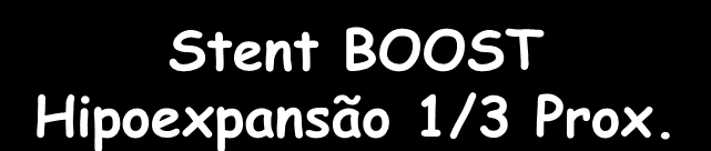 Stent BOOST Hipoexpansão 1/3 Prox. Balão 3.