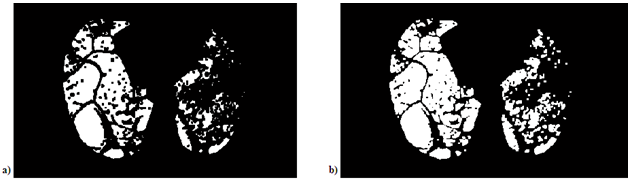 enfisema após a liminarização. A figura 13.b) representa a aplicação da operação de majoritariedade, a qual preenche melhor a área acometida por enfisema. Figura 13.