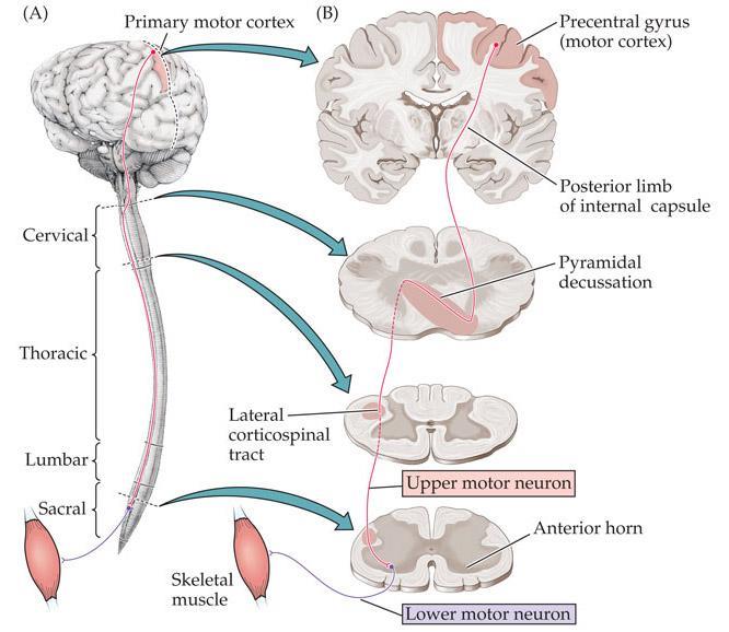 SÍNDROME CENTROMEDULAR 1º PARESIA/PLEGIA ESPÁSTICA HIPERREFLEXIA SINAL