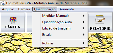 Aba QUANTIFICÃO Medidas Manuais / Quantificação Automática / Edição de Imagem / Escalas / Rotinas Aba AUMENTO Nova Calibração / Excluir Calibração /