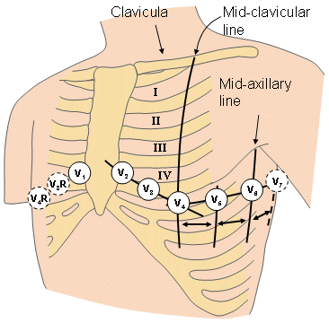 17 Figura 3: Derivações cardíacas Fonte: (MALMIVUO; PLONSEY, 1995) para descrever completamente o vetor elétrico cardíaco.