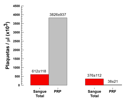59 Figura 30 Gráfico comparativo entre a concentração plaquetária no sangue total, no Plasma Rico em Plaquetas e na Fibrina Rica em Plaquetas ST: sangue total; PRP: plasma rico em plaquetas; PRF: