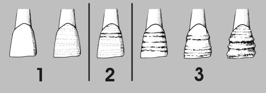 Apêndice IV CRIBRA ORBITÁLIA Códigos de Steckel et al., 2006 0 Órbita não presente para observação. 1 Ausente em pelo menos uma das órbitas examinadas.