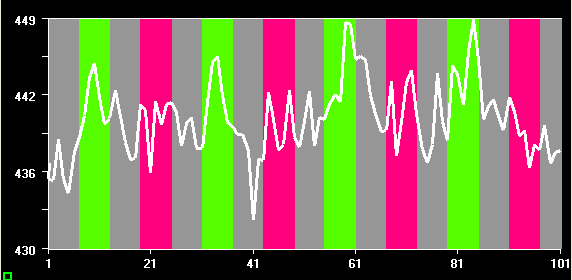 acentuada ao movimento, como pode ser comprovado pelo