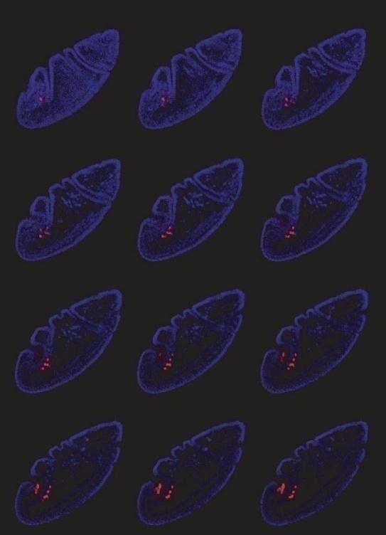 Imagem mostra a parte posterior de um embrião de Drosophila melanogaster 3 horas após fertilização.