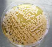 Fusarium sp. Torneira Fusarium solani, C. parapsilosis, Exophiala sp.