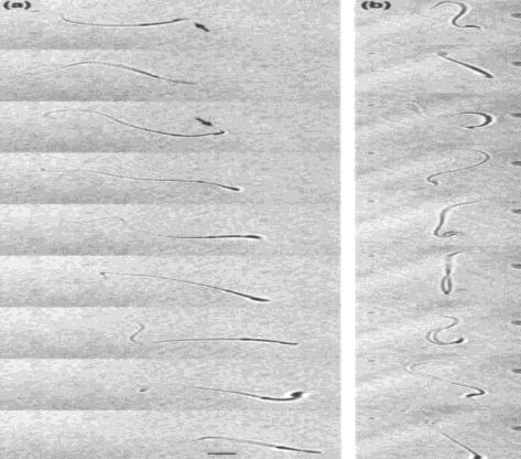 de proteínas extrínsecas Bicarbonato, Heparina Perda de colesterol na superfície Albumina