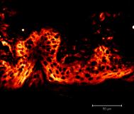 %T Nanopartículas Lipídicas Sólidas Produção de NLS utilizando ceras da