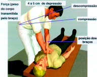 14 HOSPITAL SÍRIO-LIBANÊS MANUAL SOBRE PCR 15 rítmica de pressão sobre o tórax, com uma freqüência de 100 vezes por minuto.