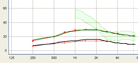 Supressor Digital de Feedback DFS II com WhistleControl Após realizada a calibração, a curva de ganho máximo é gerada.