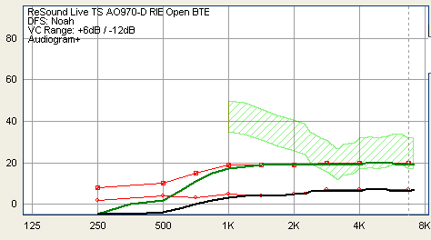 Em que situações posso modificar os ajustes do WhistleControl?