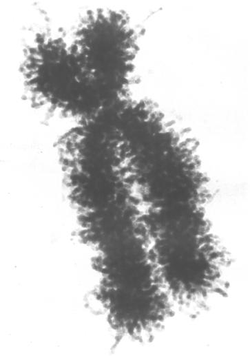 Cromatina: Conjunto de fios ( DNA + Histonas); Heterocromatina: