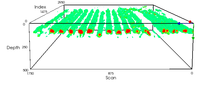 Entretanto, quando se utiliza um grid com maior espaçamento (10 x 25 cm) há uma redução no nível de detalhes capturados pela tomografia 3D, o que é mostrado na figura 6.