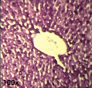 Lipídios adipócitos Pigmentos - hemoglobina, melanina Cristais - células de