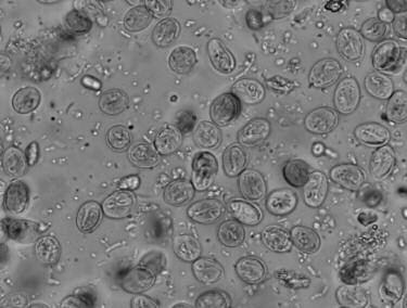 Podem ser adicionados vários tipos de corantes para evidenciar estruturas facilitando a identificação de quistos e trofozoítos, sendo os mais utilizados a solução de Lugol, o azul de metileno e a