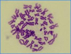 origem paterna) imagem da célula em microscópio óptico Cariótipo de um