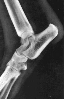 Radiografia da articulação do joelho em projeção tangencial Posicionamento da articulação