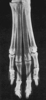 Radiografia da articulação tarsal em projeção dorsolateral-medioplantar