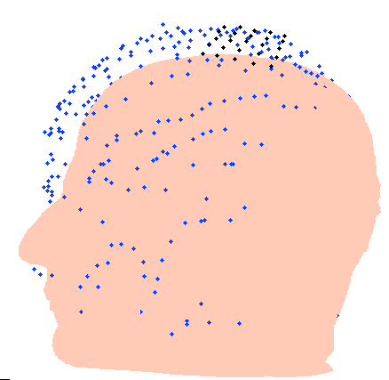 81 Na Figura 34 pode-se observar a nuvem de pontos coletados sobre a cabeça de um voluntário utilizando o InVesalius, e o posterior corregistro da nuvem de pontos com a imagem de ressonância
