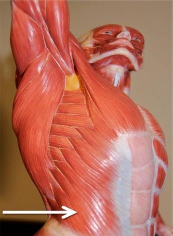 Na readmissão, após 6 semanas: alívio parcial do quadro de dor perineal, sem resolução completa dor no escroto, à direita, com irradiação à face interna da coxa