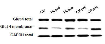 62 Figura 13. Efeitos da suplementação de creatina sobre a translocação de GLUT-4 (razão GLUT-4 membranar/total). A linha tracejada representa a média obtida em cinco pacientes saudáveis.