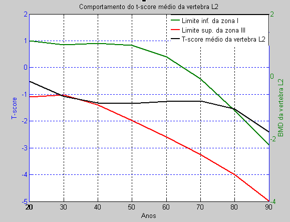 3.5 Análise dos Resultados 41 também, que entre os 20 40 anos o T-score situa-se na zona II, sendo que a partir 40 anos, o valor de t-score aumenta, até que a partir dos 70 anos segue a curva do