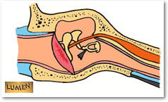 Meato acústico Tubo aberto (pavilhão) e fechado no tímpano ~2,5 cm de
