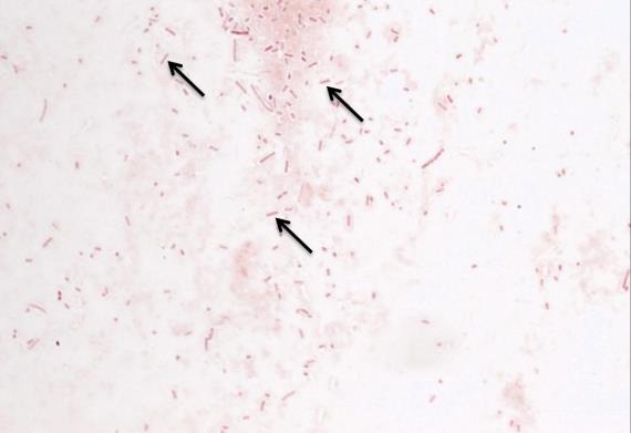 influenzae é um organismo exigente que cresce melhor a 35-37 C com aproximadamente 5% de CO2 e requer hemina (fator X) e nicotinamida adenina dinucleotídeo (fator V) para o seu crescimento (Jawetz et