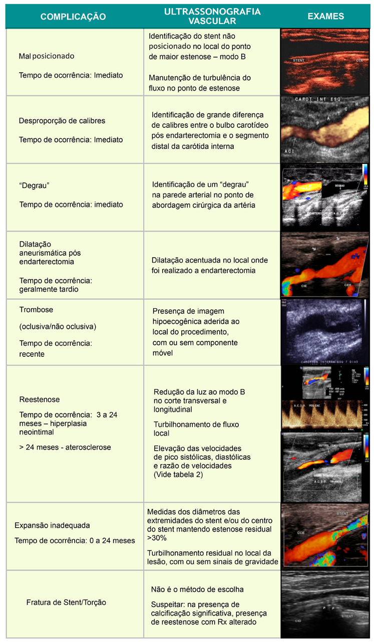 Quadro 8 Complicações pós-intervenção: