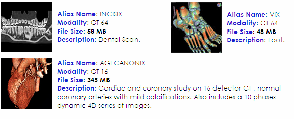 Capítulo 5 Metodologia do Trabalho Desenvolvido 114 Figura 5.5: Exemplo de uma série de Imagens de CT de Abdômen Superior em Corte Axial. Todas as imagens estão em formato DICOM 3.